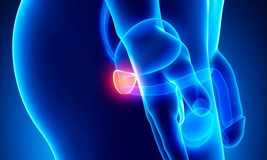 vnetje prostate s prostatitisom